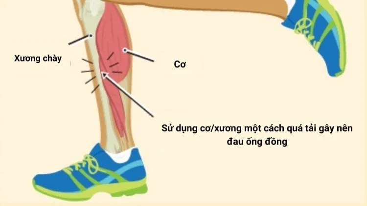 cam-nang-phong-tranh-chan-thuong-khi-chay-bo-hieu-qua-nhat-109